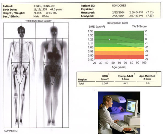 Body Composition – DEXASCANNEARME